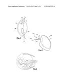 SYSTEMS AND METHODS FOR PRIMING AN INTRAOCULAR PRESSURE SENSOR CHAMBER diagram and image