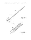 SOFT TISSUE CORING BIOPSY DEVICES AND METHODS diagram and image