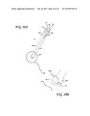 SOFT TISSUE CORING BIOPSY DEVICES AND METHODS diagram and image