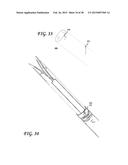 SOFT TISSUE CORING BIOPSY DEVICES AND METHODS diagram and image