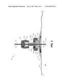 DEVICES AND METHODS FOR OBTAINING TISSUE SAMPLES diagram and image