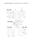 STEREOTACTIC SOFT TISSUE CORING BIOPSY DEVICES AND METHODS diagram and image