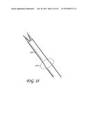 STEREOTACTIC SOFT TISSUE CORING BIOPSY DEVICES AND METHODS diagram and image