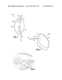 BUBBLE-FREE MICROFLUIDIC VALVE SYSTEMS AND METHODS diagram and image