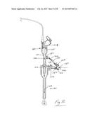 INSUFFLATION SYSTEM diagram and image