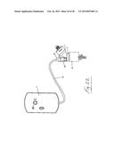 INSUFFLATION SYSTEM diagram and image