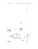 Catheter Apparatuses, Systems, and Methods for Renal Neuromodulation diagram and image