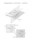 Catheter Apparatuses, Systems, and Methods for Renal Neuromodulation diagram and image