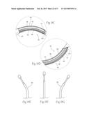 Catheter Apparatuses, Systems, and Methods for Renal Neuromodulation diagram and image