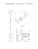 Catheter Apparatuses, Systems, and Methods for Renal Neuromodulation diagram and image