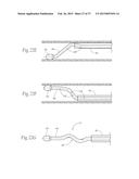 Catheter Apparatuses, Systems, and Methods for Renal Neuromodulation diagram and image