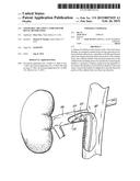 STEERABLE ABLATION CATHETER FOR RENAL DENERVATION diagram and image