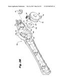 STEERABLE ABLATION CATHETER FOR RENAL DENERVATION diagram and image