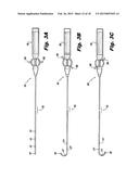 STEERABLE ABLATION CATHETER FOR RENAL DENERVATION diagram and image