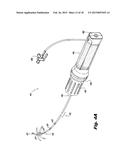 STEERABLE ABLATION CATHETER FOR RENAL DENERVATION diagram and image