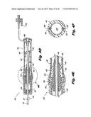 STEERABLE ABLATION CATHETER FOR RENAL DENERVATION diagram and image