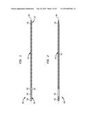 FLEXIBLE INTRAMEDULLARY ROD diagram and image