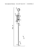 FLEXIBLE INTRAMEDULLARY ROD diagram and image