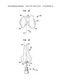 FLEXIBLE INTRAMEDULLARY ROD diagram and image