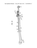 FLEXIBLE INTRAMEDULLARY ROD diagram and image