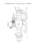 FLEXIBLE INTRAMEDULLARY ROD diagram and image