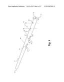 Intramedullary Nail, System, and Method With Dynamic Compression diagram and image