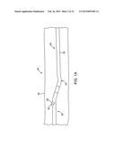 Debulking Catheters and Methods diagram and image