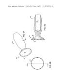 Debulking Catheters and Methods diagram and image