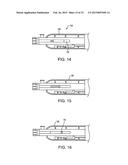 Debulking Catheters and Methods diagram and image