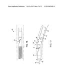 Debulking Catheters and Methods diagram and image