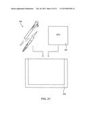 Debulking Catheters and Methods diagram and image