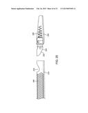 Debulking Catheters and Methods diagram and image