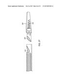 Debulking Catheters and Methods diagram and image