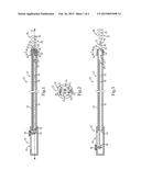 DETACHABLE TREATMENT DEVICE DELIVERY SYSTEM WITH NARROWED DIAMETER REGION     AT ATTACHMENT ZONE diagram and image