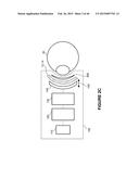 SYSTEMS AND METHODS FOR THE TREATMENT OF EYE CONDITIONS diagram and image