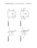 SYSTEMS AND METHODS FOR THE TREATMENT OF EYE CONDITIONS diagram and image