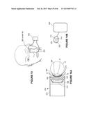 SYSTEMS AND METHODS FOR THE TREATMENT OF EYE CONDITIONS diagram and image