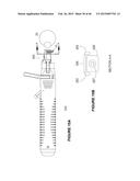 SYSTEMS AND METHODS FOR THE TREATMENT OF EYE CONDITIONS diagram and image