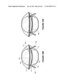 SYSTEMS AND METHODS FOR THE TREATMENT OF EYE CONDITIONS diagram and image