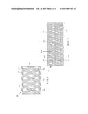 BRAIDED HEMOSTASIS SHAFT FOR IMPROVED TORSIONAL RESPONSE diagram and image