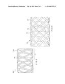 BRAIDED HEMOSTASIS SHAFT FOR IMPROVED TORSIONAL RESPONSE diagram and image