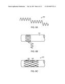 BIOABSORBABLE IMPLANTS diagram and image