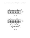 BIOABSORBABLE IMPLANTS diagram and image