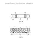 BIOABSORBABLE IMPLANTS diagram and image