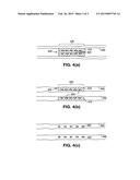 METHODS OF TREATMENT WITH DRUG DELIVERY AFTER BIODEGRADATION OF THE STENT     SCAFFOLDING diagram and image