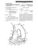 Knee Prosthesis Assembly With Ligament Link diagram and image