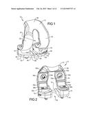 Knee Prosthesis Assembly With Ligament Link diagram and image