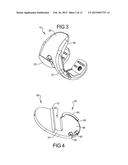 Knee Prosthesis Assembly With Ligament Link diagram and image