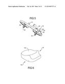 Knee Prosthesis Assembly With Ligament Link diagram and image