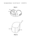 Knee Prosthesis Assembly With Ligament Link diagram and image